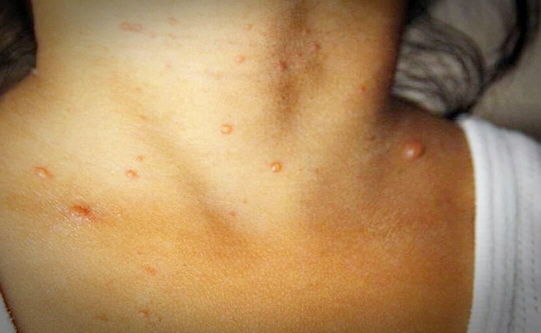 (Foto: Cuauhtémoc Moreno)