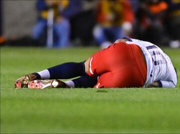 Alexis Vega entrará al quirófano el miércoles