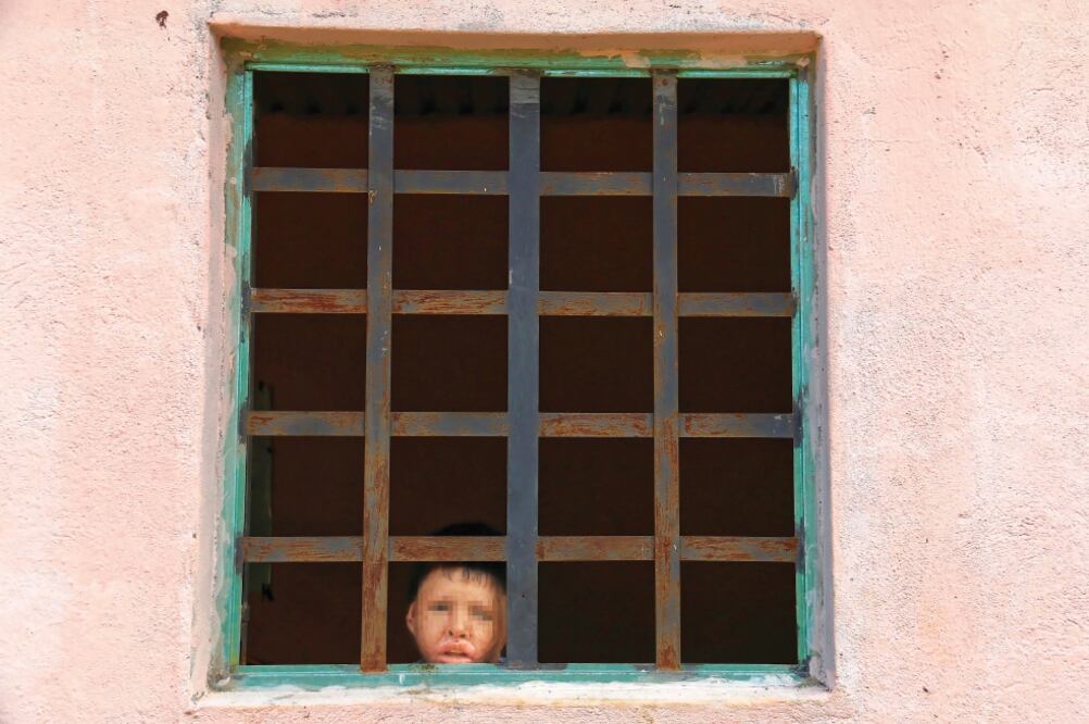 José Candelero Correa, de 12 años, sufrió quemaduras graves de segundo y tercer grado en 90% de su cuerpo, perdió la mano izquierda y usa un traje de neopreno debido a sus lesiones (LUMA LÓPEZ)