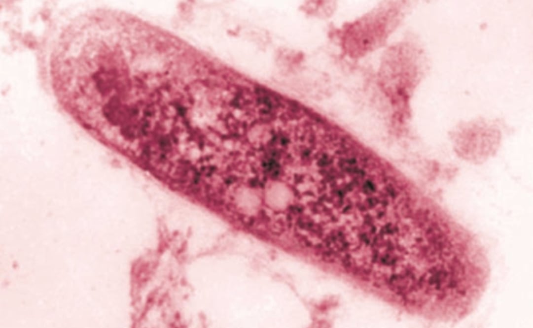 Zoomed-in image of the bacteria Mycobacterium tuberculosis - Image courtesy of the UNAM
