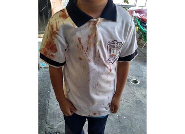 Alumno regresa ensangrentado de la primaria “por bullying” en Morelos
