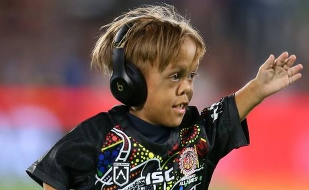 Quaden fue ovacionado en un partido de estrellas de rugby en Australia. Foto: Getty Images