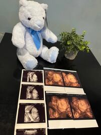 Quedó embarazada tras un encuentro casual y ahora busca al padre en TikTok