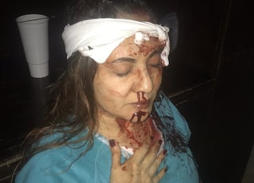 Imaginen despertar en la madrugada porque tu madre grita por su vida: hija de Abril