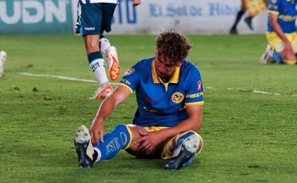 Igor Lichnovsky será baja del América; se desconoce cuánto tiempo estará sin jugar