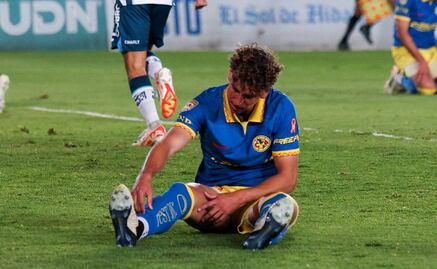 Igor Lichnovsky será baja del América; se desconoce cuánto tiempo estará sin jugar