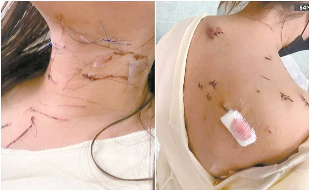 Mya Villalobos fue apuñalada en 47 ocasiones por su expareja cuando quiso terminar la relación; las heridas le perforaron un pulmón y la mantienen limitada para realizar ciertas actividades físicas.