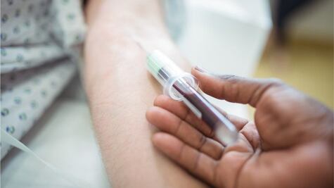 El análisis de sangre que permite detectar el alzheimer hasta 20 años antes