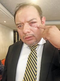 Suspenden a 'polis' por agredir a regidor