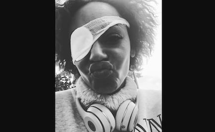 Mel B usaría un parche en el ojo en el regreso de las Spice Girls