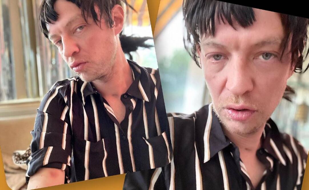 Camilo Blanes, hijo del fallecido Camilo Sesto, ha tenido problemas de salud en los últimos meses. Foto: Instagram camiloblanesoficial.