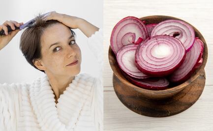 Cómo usar agua de cebolla para evitar la caída del cabello