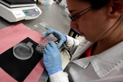 Identificar síntomas de Alzheimer contribuye a mejorar calidad de vida de pacientes: IMSS