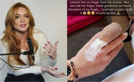 Lindsay Lohan pierde parte de un dedo en accidente