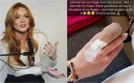 Lindsay Lohan pierde parte de un dedo en accidente