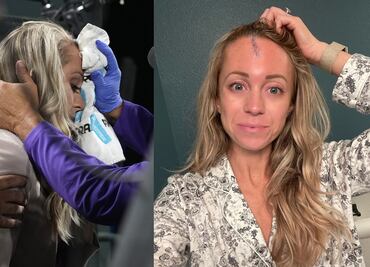 Reportera de los Rockies recibe pelotazo que iba a 150 km por hora