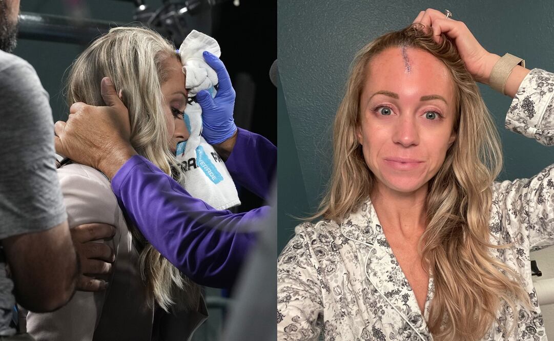 Reportera de los Rockies recibe pelotazo que iba a 150 km por hora / FOTO: ESPECIAL