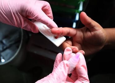 Por primera vez en 10 años, una vacuna contra el VIH llega a su última fase de ensayos