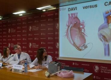 Video. Así es como funciona un corazón artificial completo