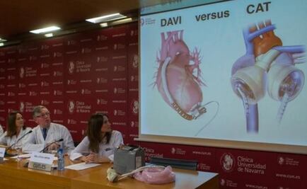 Video. Así es como funciona un corazón artificial completo