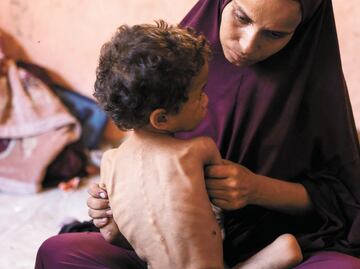 La OMS denuncia hambruna masiva en Gaza; Israel lo niega