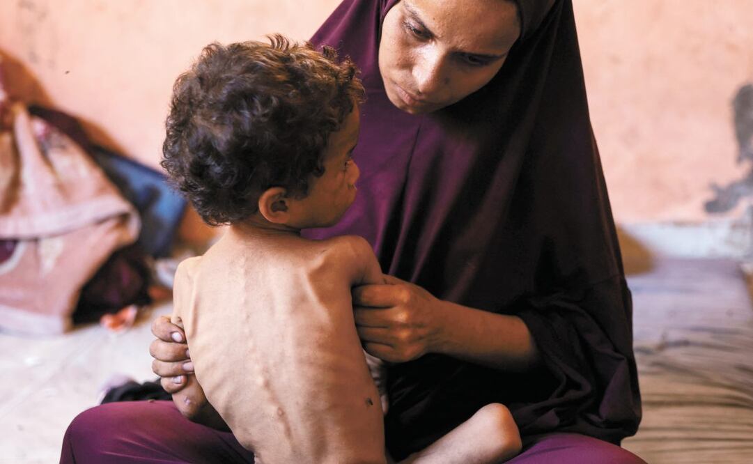 Naeema, palestina, con su hijo Yazan, de 2 años, quien sufre desnutrición severa, en un campo de refugiados. El director de la OMS denunció que “hay gente muriendo masivamente de hambre” en el territorio. Israel negó que haya hambruna y culpó a Hamas de la escasez de comida. Foto: Omar Al-Qattaa / AFP