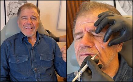 Tras salir de prisión, “Cuco” Rovirosa presume nuevo rostro gracias al bótox; buscará por tercera ocasión la alcaldía de Macuspana 