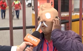 "Ya son 26 años con el rostro así"; María Consuelo, víctima de ataque con ácido en Colombia, contempla la eutanasia