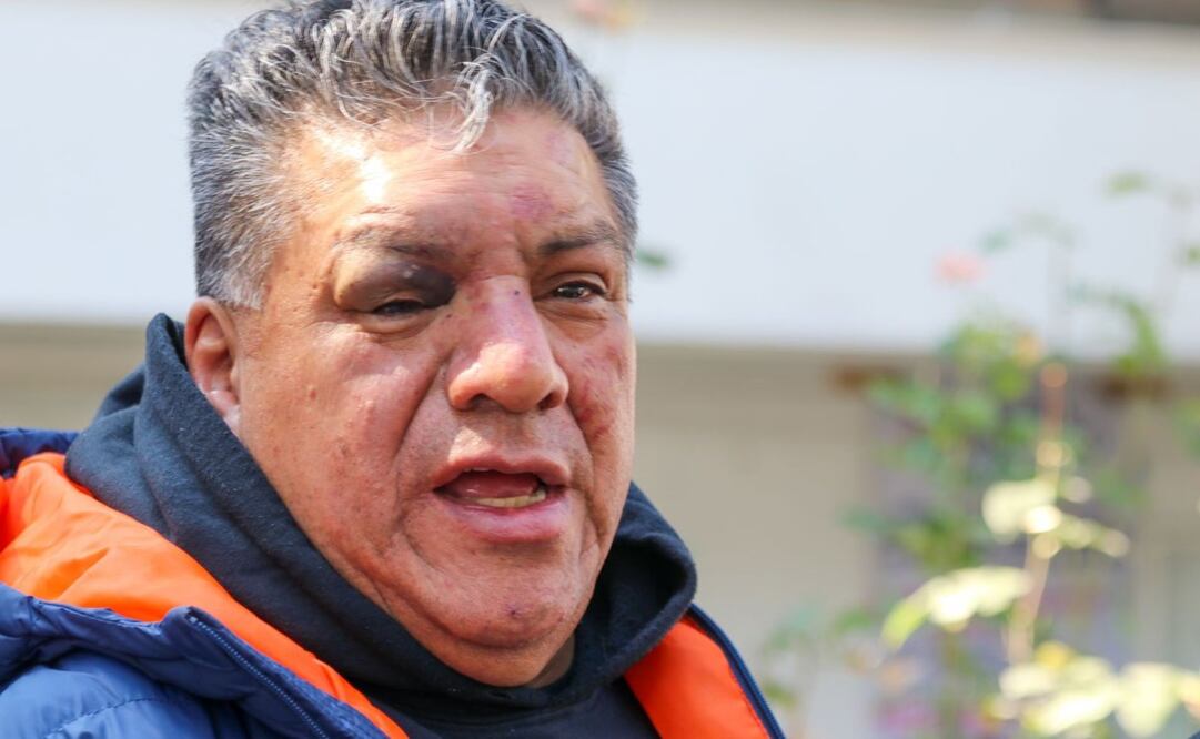 Arnulfo Aguilar, líder del Sonido Cóndor, fue liberado después de que anoche fuera detenido por golpear a policías quienes pretendían decomisarle su equipo mediante un operativo. (12/12/24) Foto: Axel Sánchez/ EL UNIVERSAL