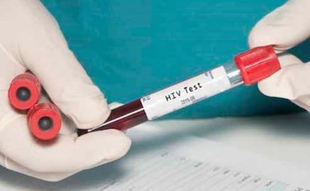 Hallan 47 mil pruebas para VIH sin registro en almacén de Veracruz