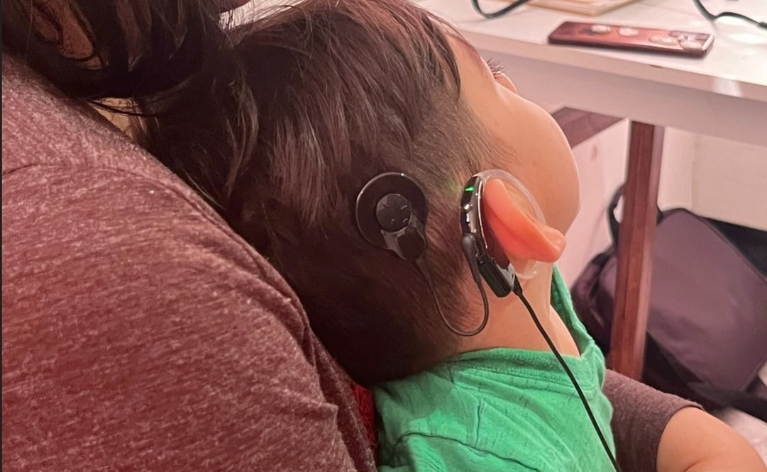 Menor de 2 años recupera capacidad auditiva tras implante coclear; es la primera operación de su tipo en un hospital del IMSS del norte del país. | Foto: Especial.