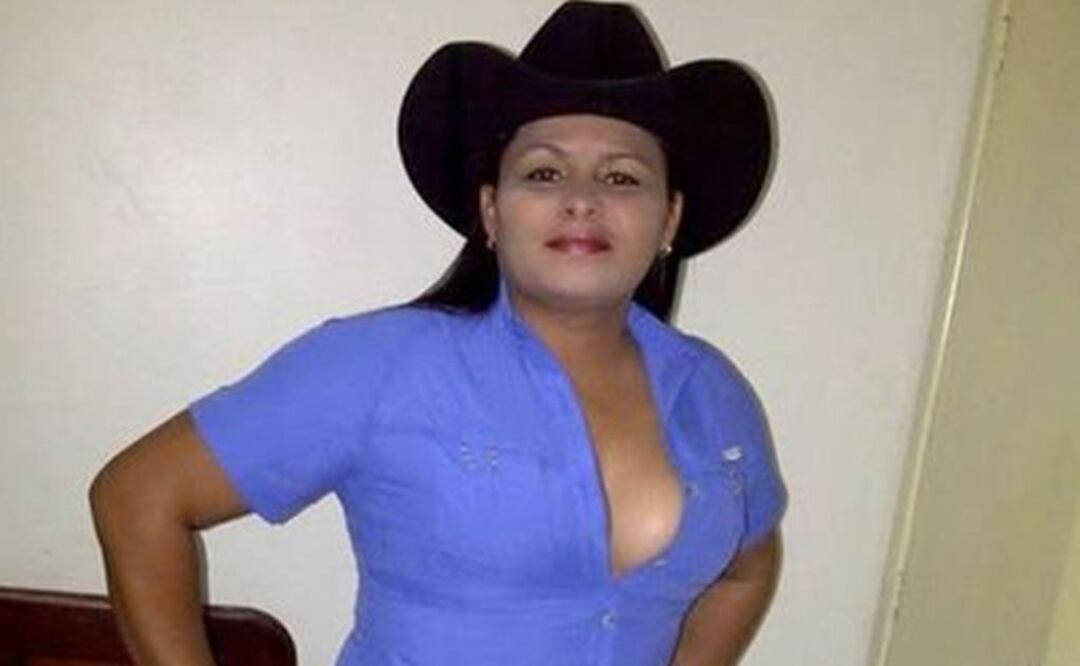 Murió luego de recibir un disparo en el pecho  Foto:Tomada de EL NACIONAL/GDA