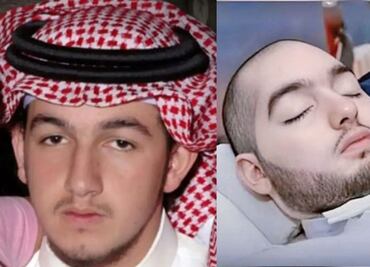¿Quién era el “Príncipe Durmiente” de Arabia Saudita?; muere a los 36 años tras dos décadas en coma
