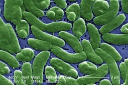 Detectan bacteria carnívora en aguas costeras de EU; autoridades de salud lanzan alerta