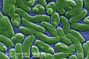 Detectan bacteria carnívora en aguas costeras de EU; autoridades de salud lanzan alerta