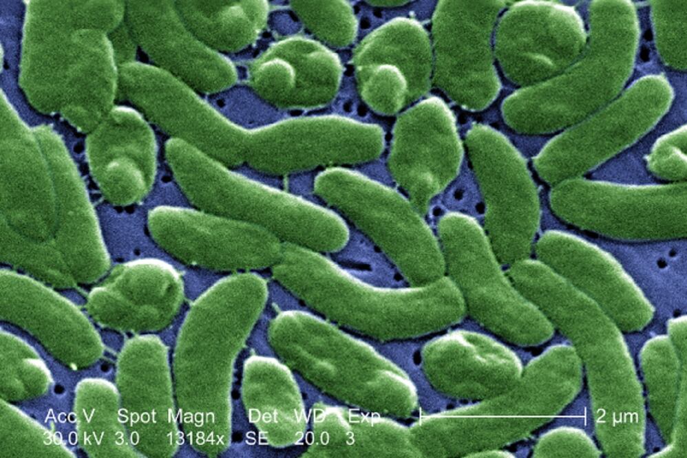 Escaneo micrográfico coloreado de Vibrio vulnificus, una bacteria carnívora que ha causado tres muertes en Estados Unidos. FOTO: ESPECIAL