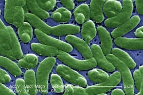 Detectan bacteria carnívora en aguas costeras de EU; autoridades de salud lanzan alerta