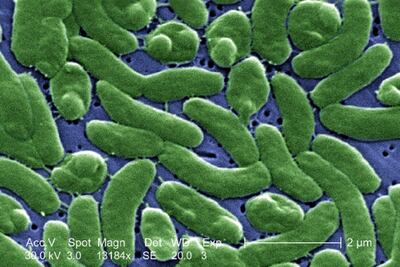 Bacteria mortal deja 3 muertos en EU. ¿Cuáles son sus síntomas?