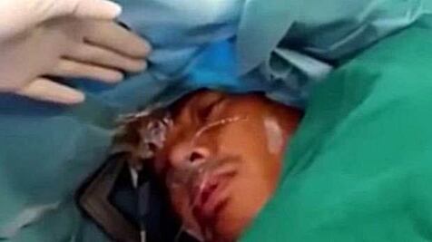 Hombre despierta en plena operación cerebral y conversa con médicos