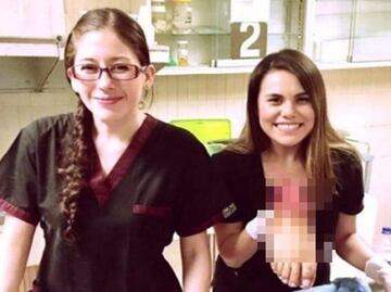 Residentes presumen foto con pie amputado en el IMSS