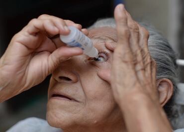 A la baja, casos de conjuntivitis en Yucatán