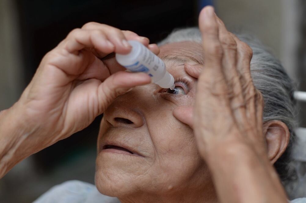 En este inicio del año se han confirmado 455 casos de conjuntivitis en Yucatán. Foto: Cuauhtémoc Moreno Cabrera