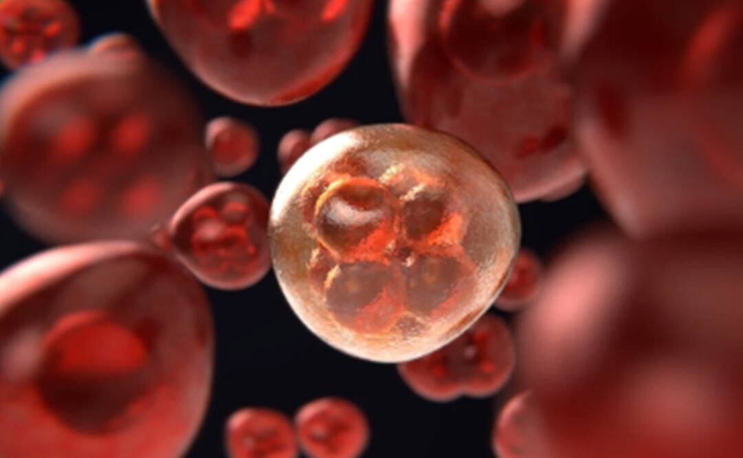 Leucemia Mieloide Aguda. Foto: Pixabay