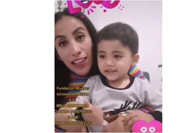 André, el niño de 2 años que necesita una operación de 90 mil pesos para salvarle la vida