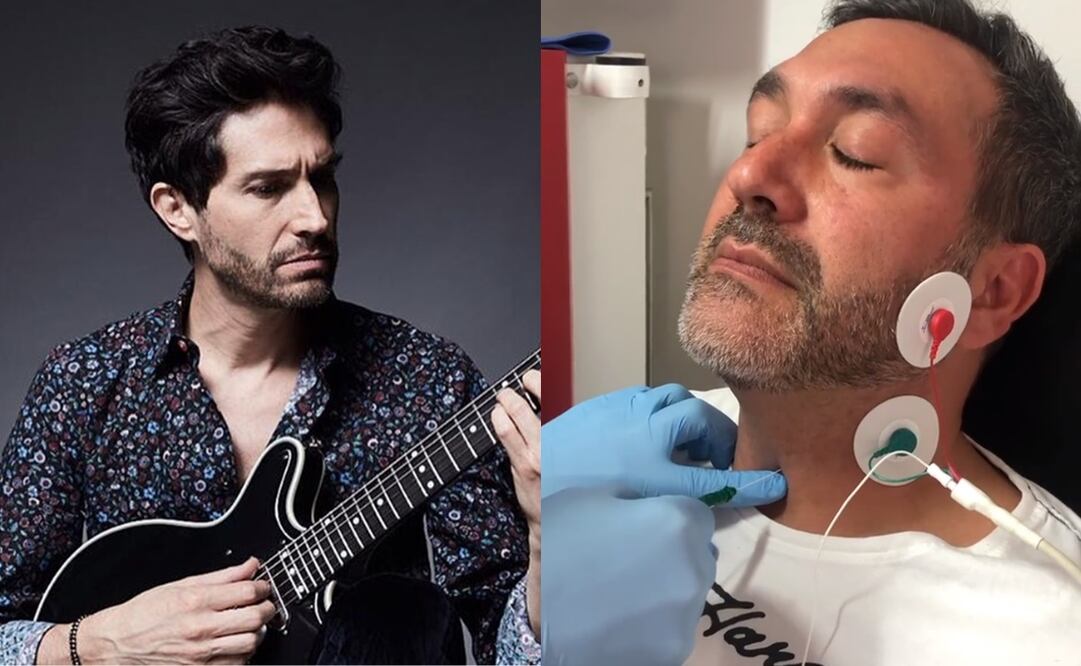 Benny Ibarra habla de la enfermedad que su hermano Alex parece desde hace 20 años.
Fotos: Instagram