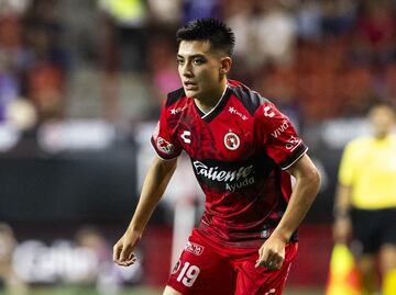 Gilberto Mora sufre una fractura; tuvo que someterse a una intervención quirúrgica