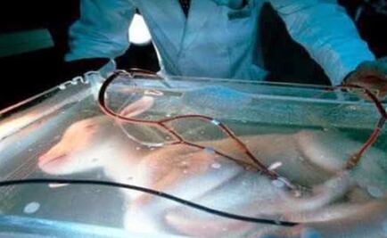 Útero artificial mantiene con vida a fetos de animales prematuros