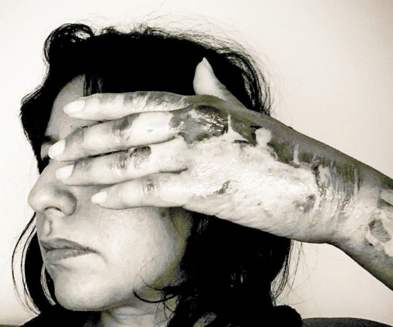 La fotorreportera de EL UNIVERSAL, Berenice Fregoso, dice que aún tiene heridas que van sanando. Foto: ESPECIAL