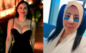 VIDEO: Sandra Cuevas da la cara tras cirugía y revela todo lo que se hizo, ¿ya es adicta al bisturí?