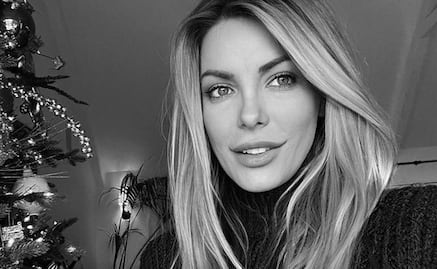 Viuda de Hugh Hefner perdió miles de seguidores por revertir cirugía estética